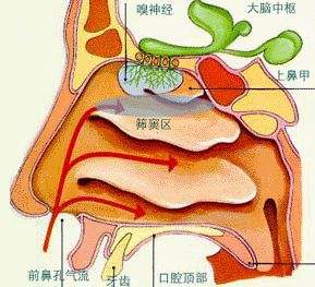 慢性上頜竇炎