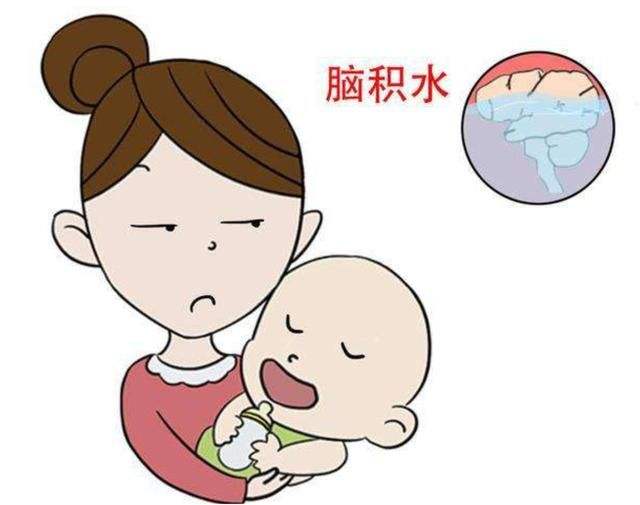 先天性腦積水