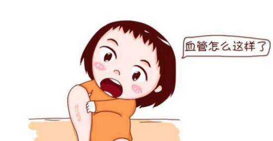 原發性下肢深靜脈瓣膜關閉不全