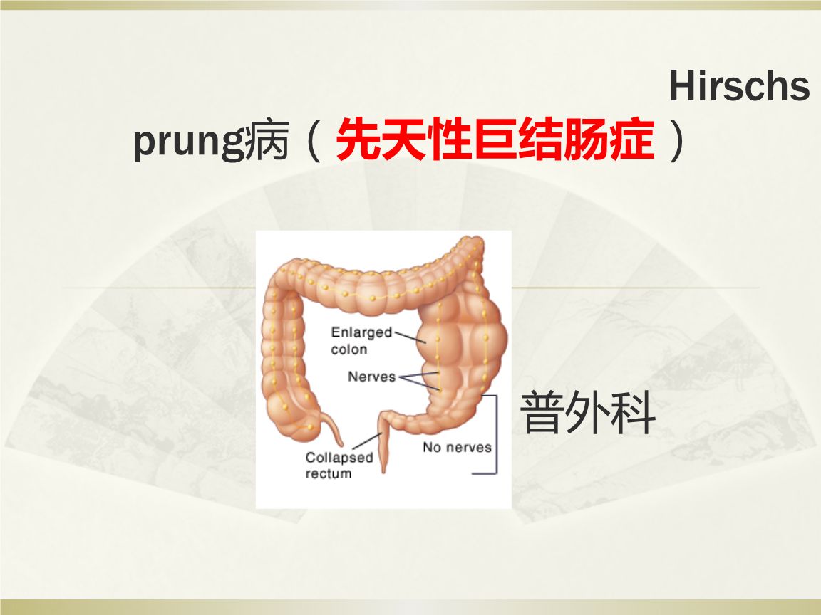 先天性巨結腸