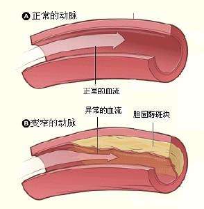 視膜毛細(xì)血管前小動(dòng)脈