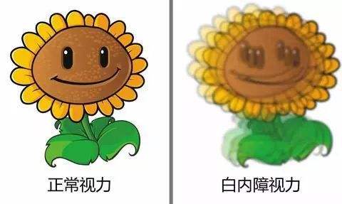白內(nèi)障