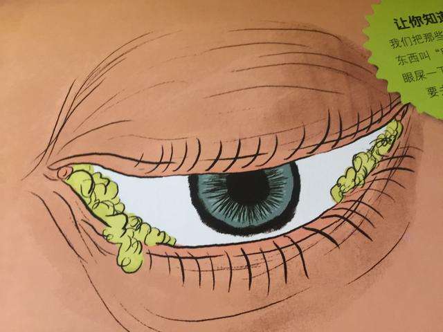 淚腺脫垂
