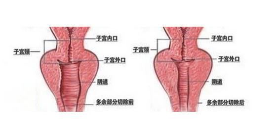女性生殖器官創傷